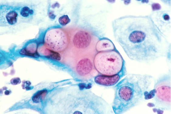 Chlamydia under the microscope